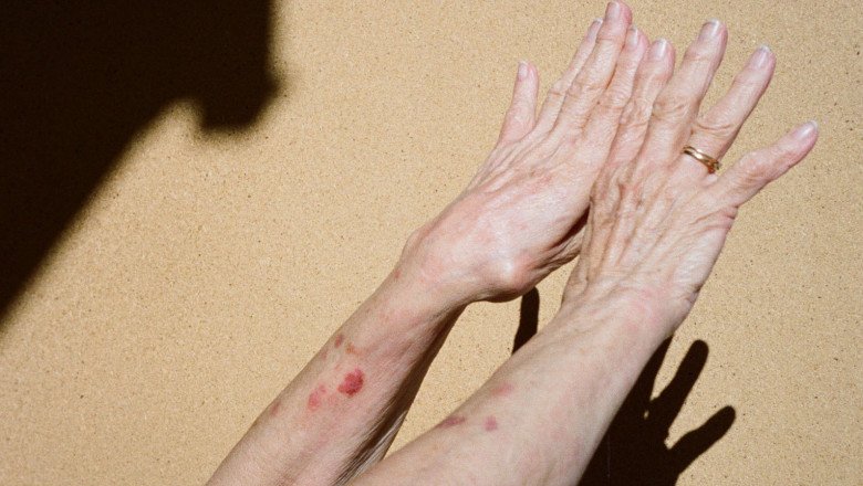 What My Two 98 Year Old Patients Taught Me About Longevity