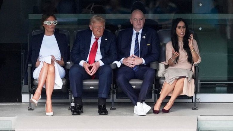Trump diagnosed with chronic venous insufficiency, a minor vein condition, after noticing swelling in legs
