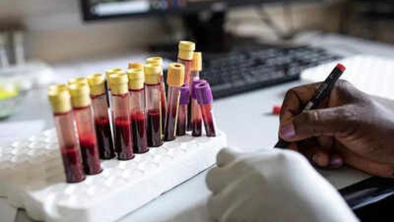 HIV jab for 115 nations rests on Indian regulators | India News